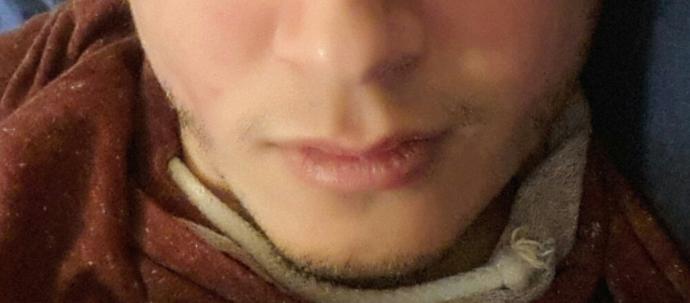 Yüz hatlarım keskin mi sizce yağ oranı düşse keskin olabilir mi?