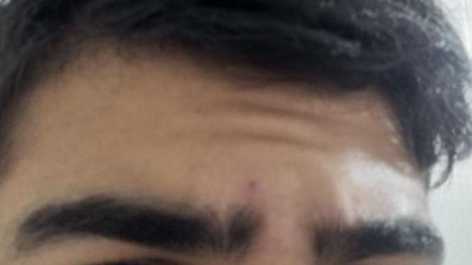 Kaşlarım ucu çok mu uzun ve nasıl sabitligini artırabilirim?