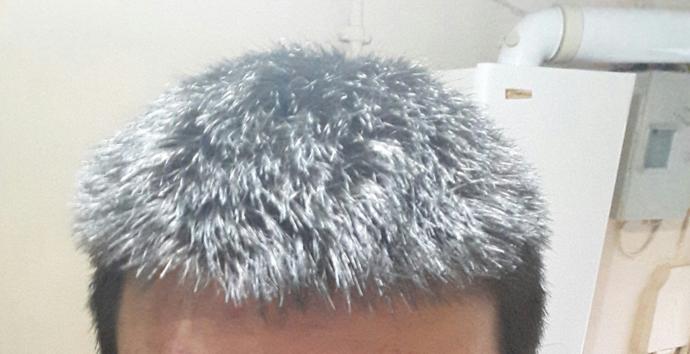Saçlarım kırılıyor ve kuru. Nasıl bir bakım yapmalıyım?