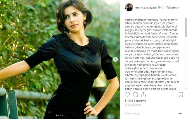 Nesrin Cavadzade, estetik güzeli haberlerine cevap verdi: Her halimle güzelim! Sizce her ünlü estetik ameliyatı mı yaptırıyor?