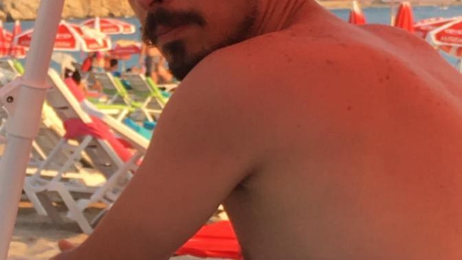 Sırtımda ki kahverengi lekeler nasıl geçer?