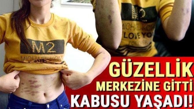 Adana’da bir Güzellik merkezinde Lazer epilasyon yaptıran Genç kızın vücudunda yanıklar oluştu, tazminat davası açmakta haklı mı?