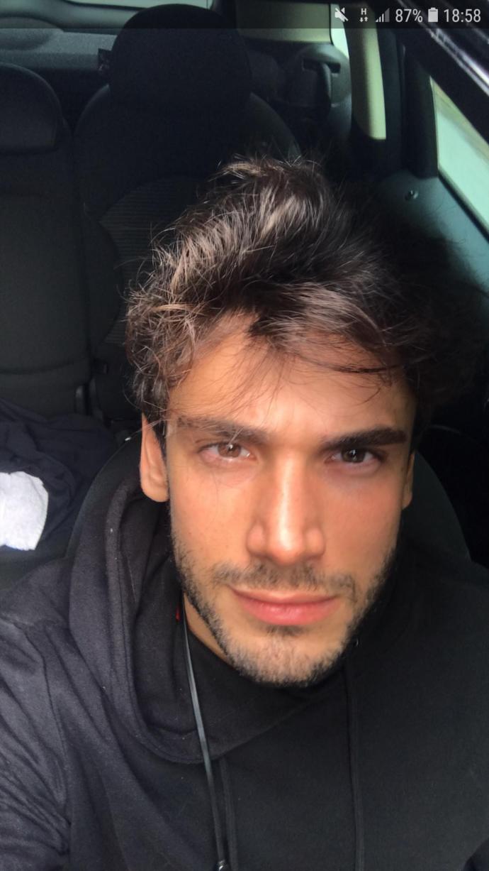 Bu adam bu tiple nasıl model olmuş🤔🤨🙄(Resimli)?