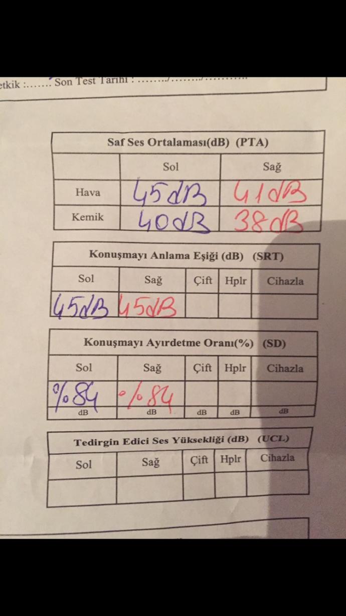 İşitme testinde yanılma varmıdır?