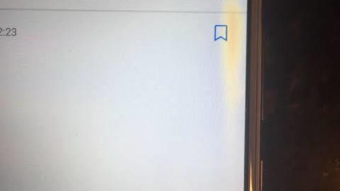 Telefon ekranındaki sarı leke sorunu hakkında yardımcı olabilir misiniz?