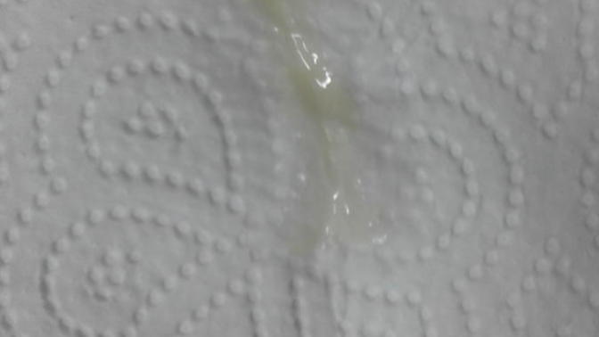 Birden böyle çok bir şekilde akintim geldi ilk defa oldu normal mi sizce?