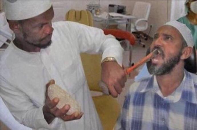 Diş tartarı temizletmenin zararı nedir?