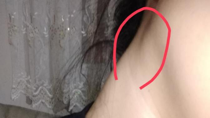 Kulak ve boyun altında olsan ceviz büyüklüğünde yağ bezesi tarzında bir şey var daha yeni fark ettim. Boğazima agri yapıyor?