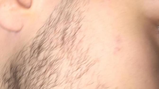 Sakallarım saç gibi çıkıyor?