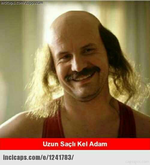 Acaba kel olmak o kadar da kötü bir şey değil mi?