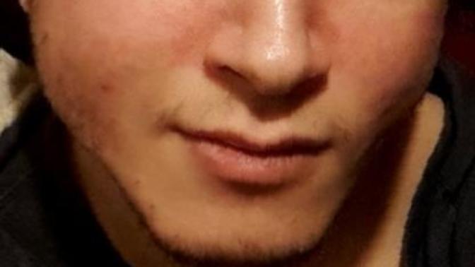 Keskin yüz hattı ve geniş köşeli çene buna benzer gibi mi oluyor sizce?