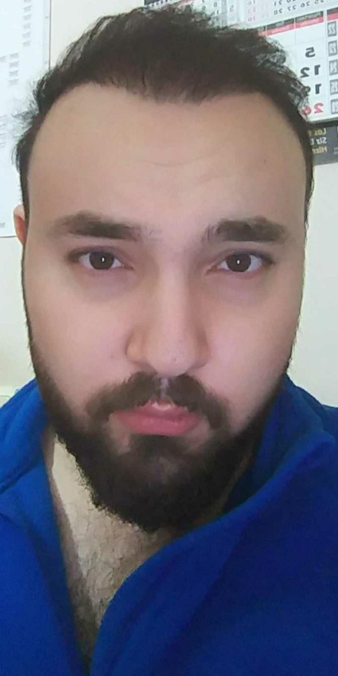 Ciddi bir soru soruyorum, burnum dıştan eğrimi duruyor?