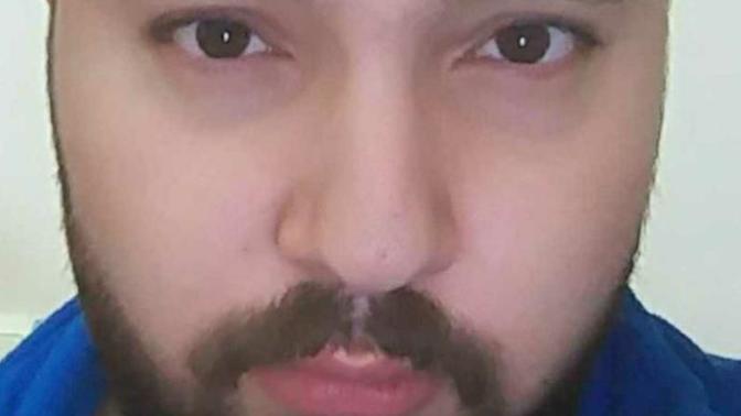 Ciddi bir soru soruyorum, burnum dıştan eğrimi duruyor?