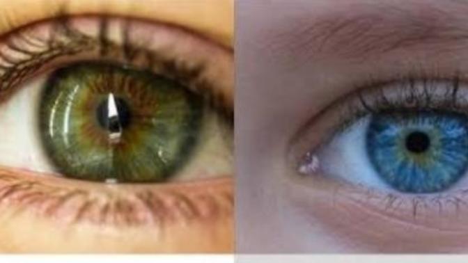 Arkadaşlar mavi lens takmak istiyorum ne dersiniz?