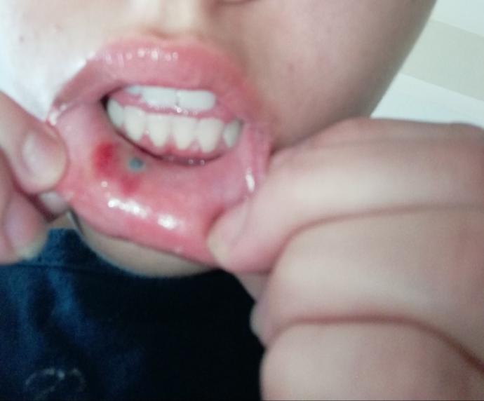 Piercing kullananlar bakabilir mi?