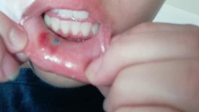 Piercing kullananlar bakabilir mi?