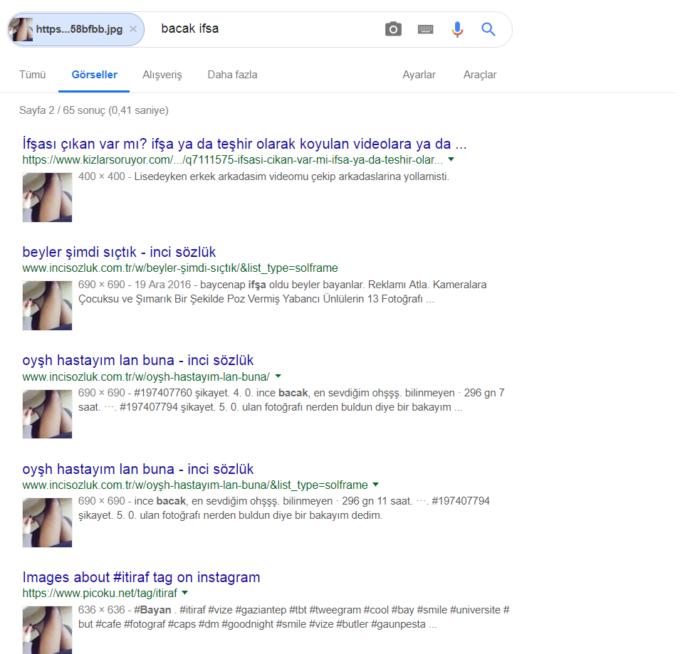 Külotlu çorap hastası erkekler mi var? Benim bacaklarımda nasıl durmuş?