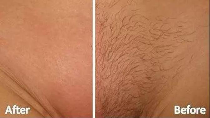 Pürüzsüz seksi ve acısız bir genital bölge traşı için sizin yönteminiz ve ya tercihiniz nedir?