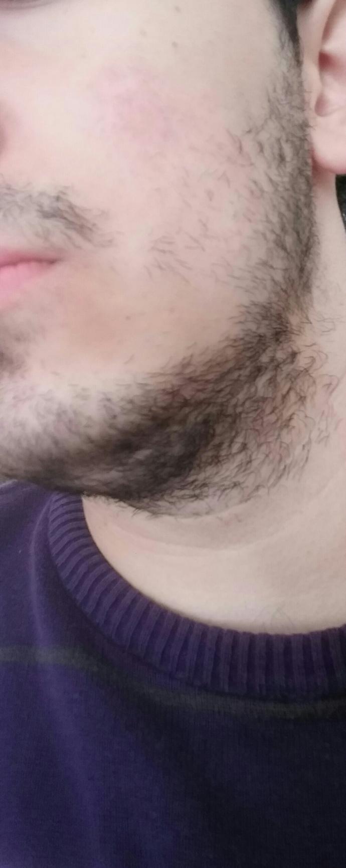 Kızlar, Sizce böyle sakal itici mi köseyim biraz, yoksa iyi mi?