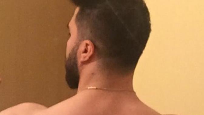 Daha önce hacamat yaptırdınız mi?