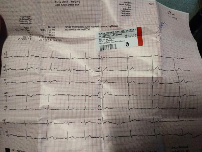 Ekg den anlayanlar bakabilir mi?