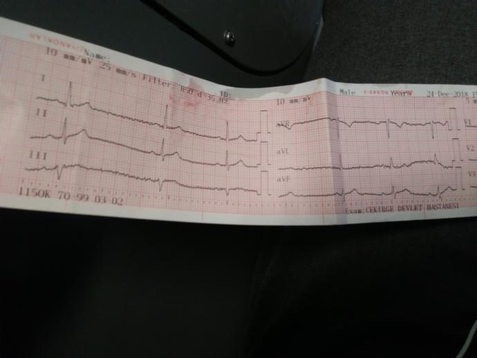 Ekg den anlayanlar bakabilir mi?
