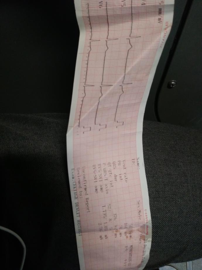 Ekg den anlayanlar bakabilir mi?