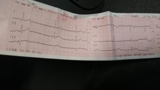 Ekg den anlayanlar bakabilir mi?
