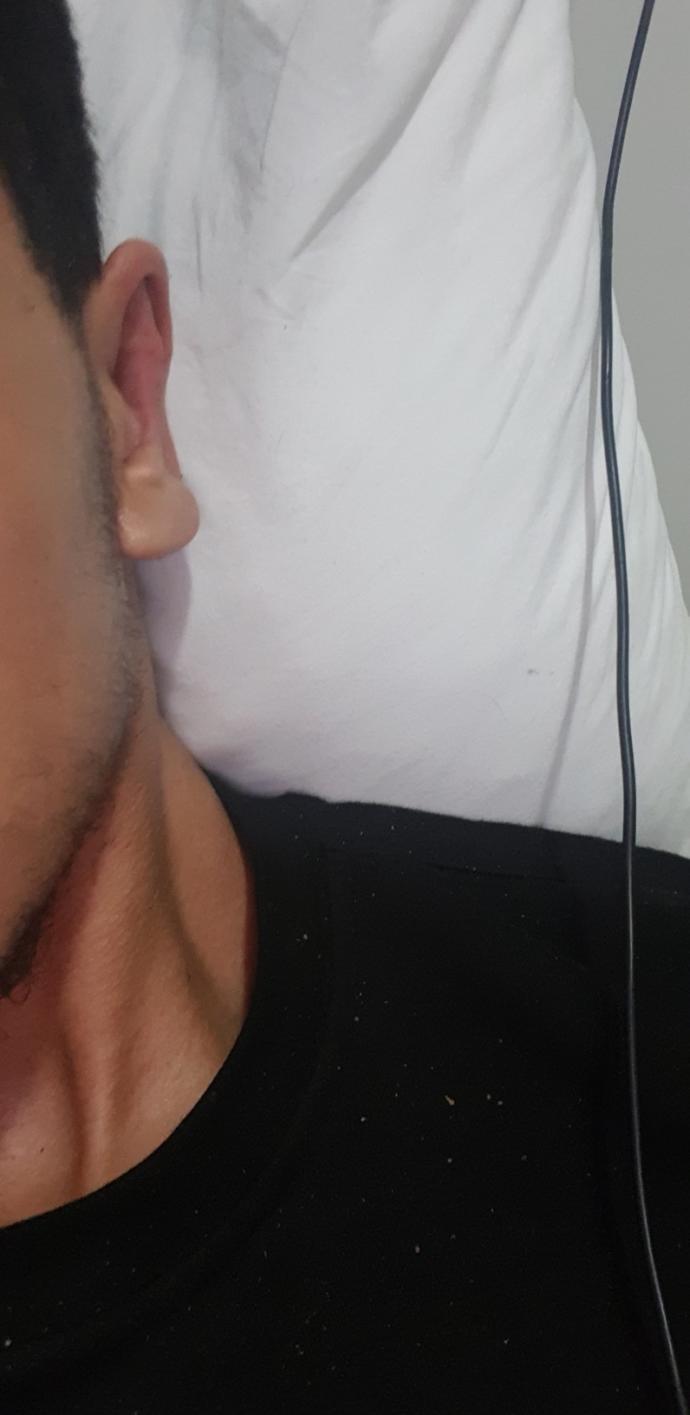 Kulak mememi nasıl düzeltebilirim?