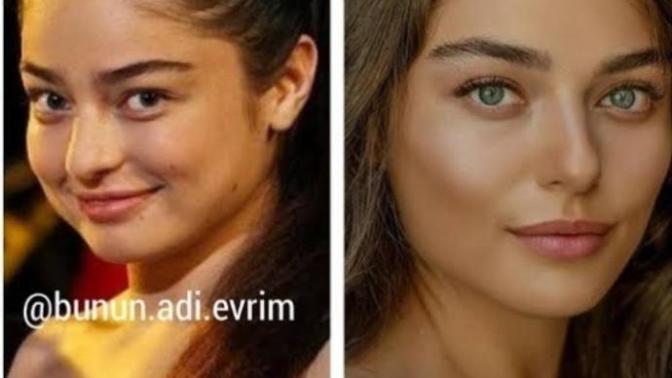 Arkadaşlar bu kızdaki değişim nedir böyle?