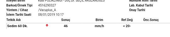 Kan testi sonuçları nasıl 😞?