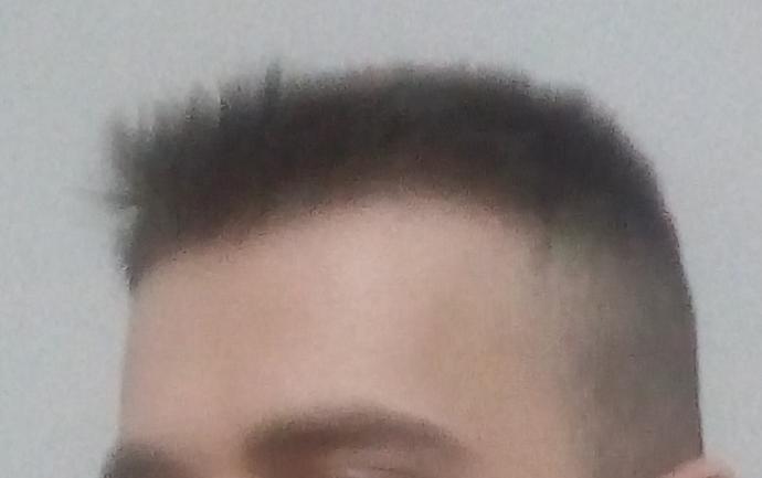 Saçlarım dökülür mü?