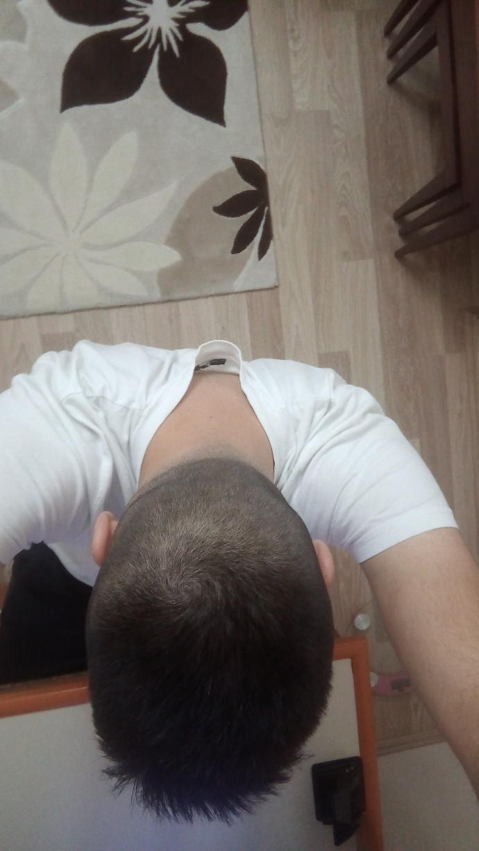 Saçlarım dökülür mü?