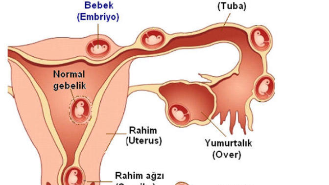 Dış gebelik nerede oluşur?