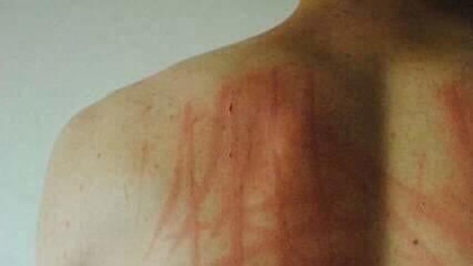 Sırtım ağrıyor biraz sizce ne olmuş olabilir?