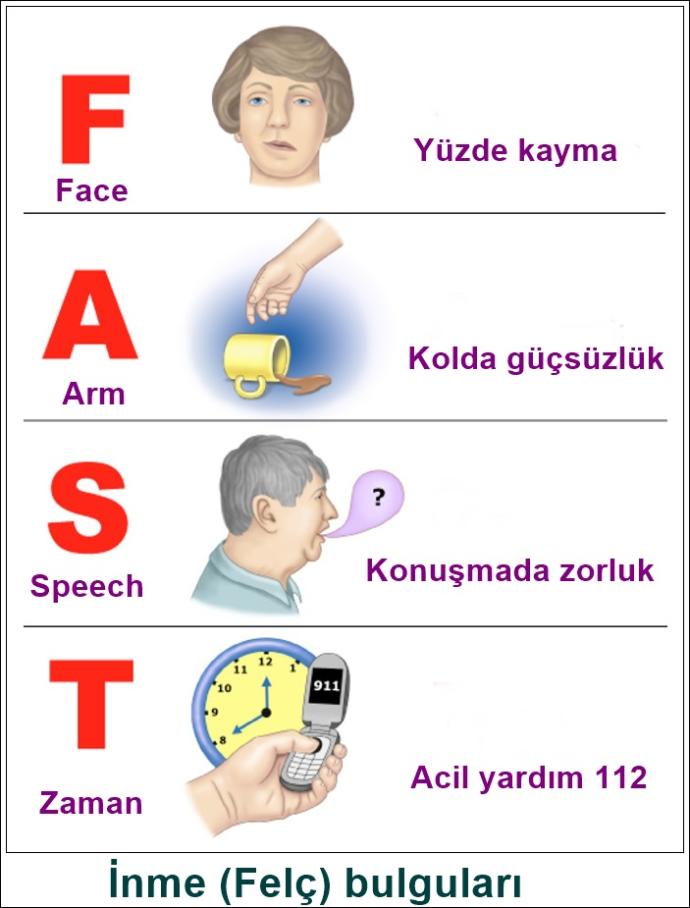 Felç (inme) 3 saat içerisinde tespit edildiğinde düzeltilebildiğini biliyor muydunuz?
