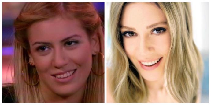 Çarpık dişleri daha güzeldi dediğiniz ünlü kim?