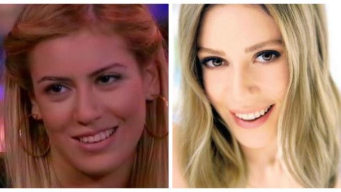 Çarpık dişleri daha güzeldi dediğiniz ünlü kim?