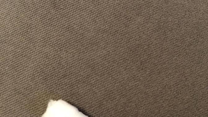 Sevgilim yanan parmağımı öpeyim geçsin dedi geçmedi, ayrılmalı mıyım?