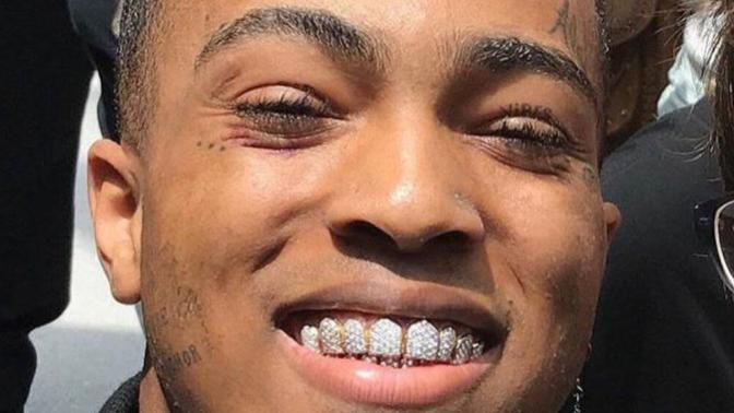 XXXTENTACION GERÇEKTEN ÖLDÜ MÜ?