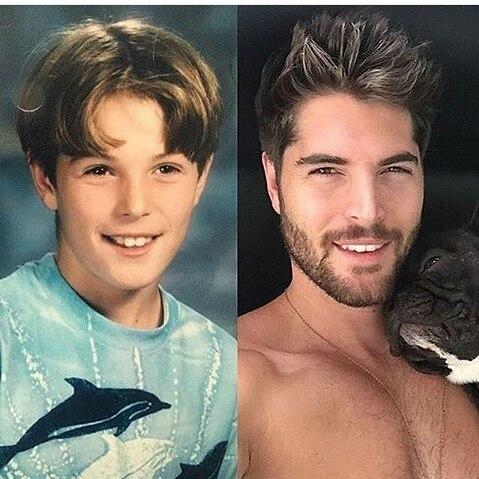 Sizce de Nick Bateman bir çok estetik operasyondan geçmemişmi?