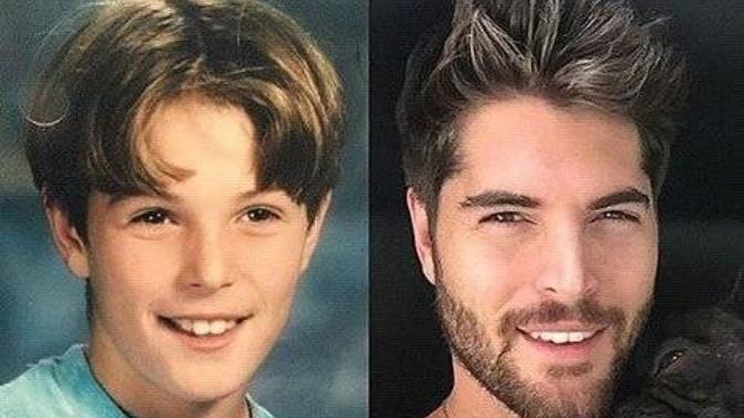 Sizce de Nick Bateman bir çok estetik operasyondan geçmemişmi?