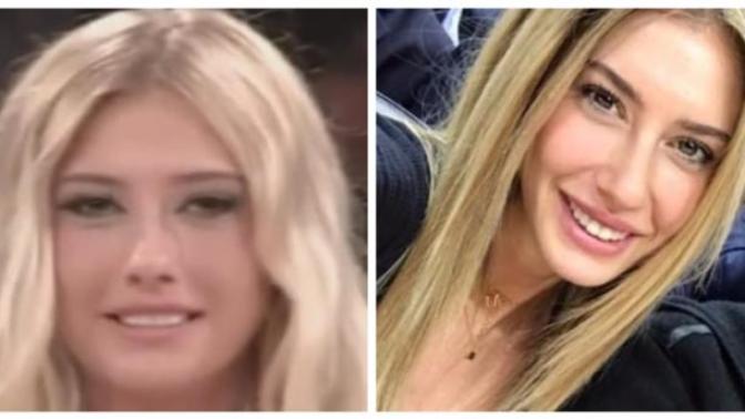 Şeyma Subaşı'nın diş yapısındaki değişiklik konusunda ne düşünüyorsunuz?