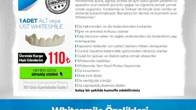 Arkadaşlar araniza kozmetik diş protezi kullanan var mı?