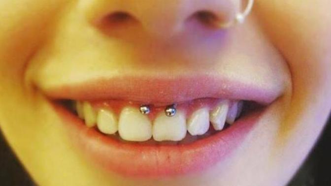Dişlere piercing takanlar itici mi sizce yoksa havalı mı?