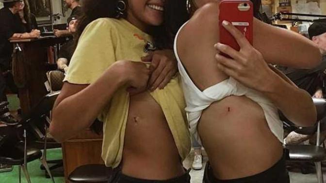 Lupus hastası olan Selena Gomez'in yine o lanet hastalığı mı ilerlemiştir?