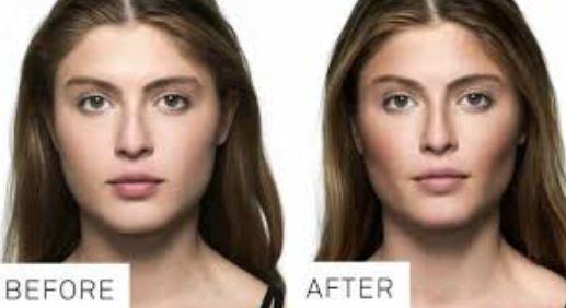 Ekte foto örneği var. Yüz nasıl zayıflar?