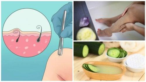 Batıklardan nasıl kurtulunur?
