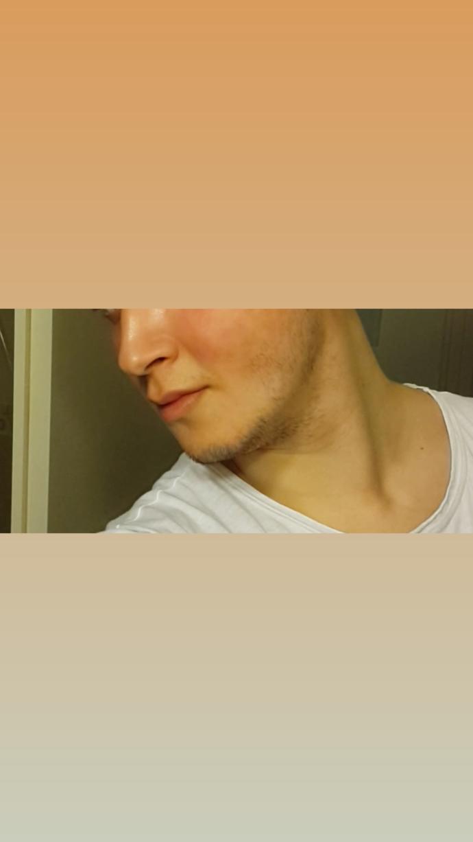 Elma yanaklımıyım yanaklarım çok tombulmu? Yağ oranım %25 e yakın göbek var biraz boy 196 kilo 94. Sporla erirmi yağ azalinca yüz?