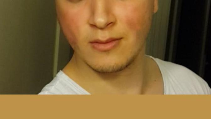 Elma yanaklımıyım yanaklarım çok tombulmu? Yağ oranım %25 e yakın göbek var biraz boy 196 kilo 94. Sporla erirmi yağ azalinca yüz?